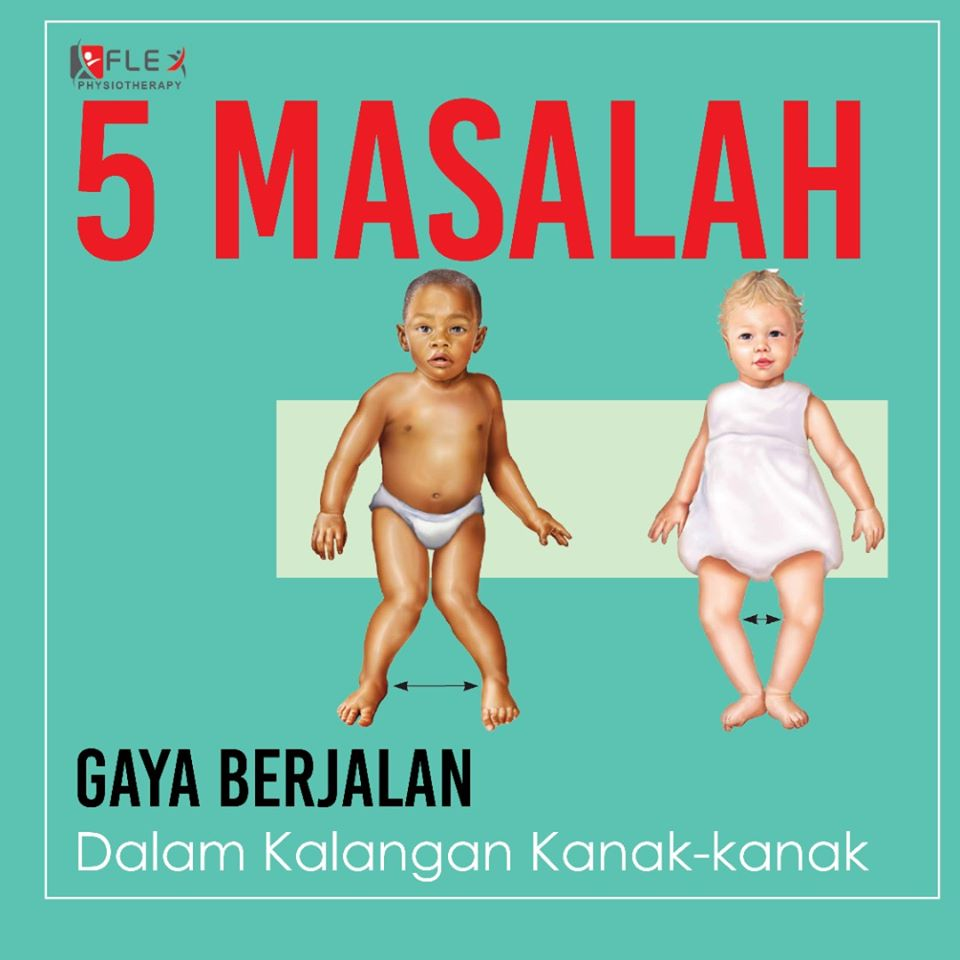 Ortopedik: Masalah Gait Kalangan Kanak-kanak