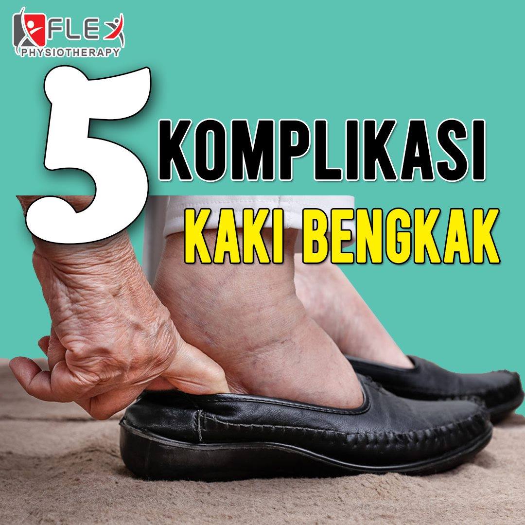Bengkak kaki hingga tak boleh jalan