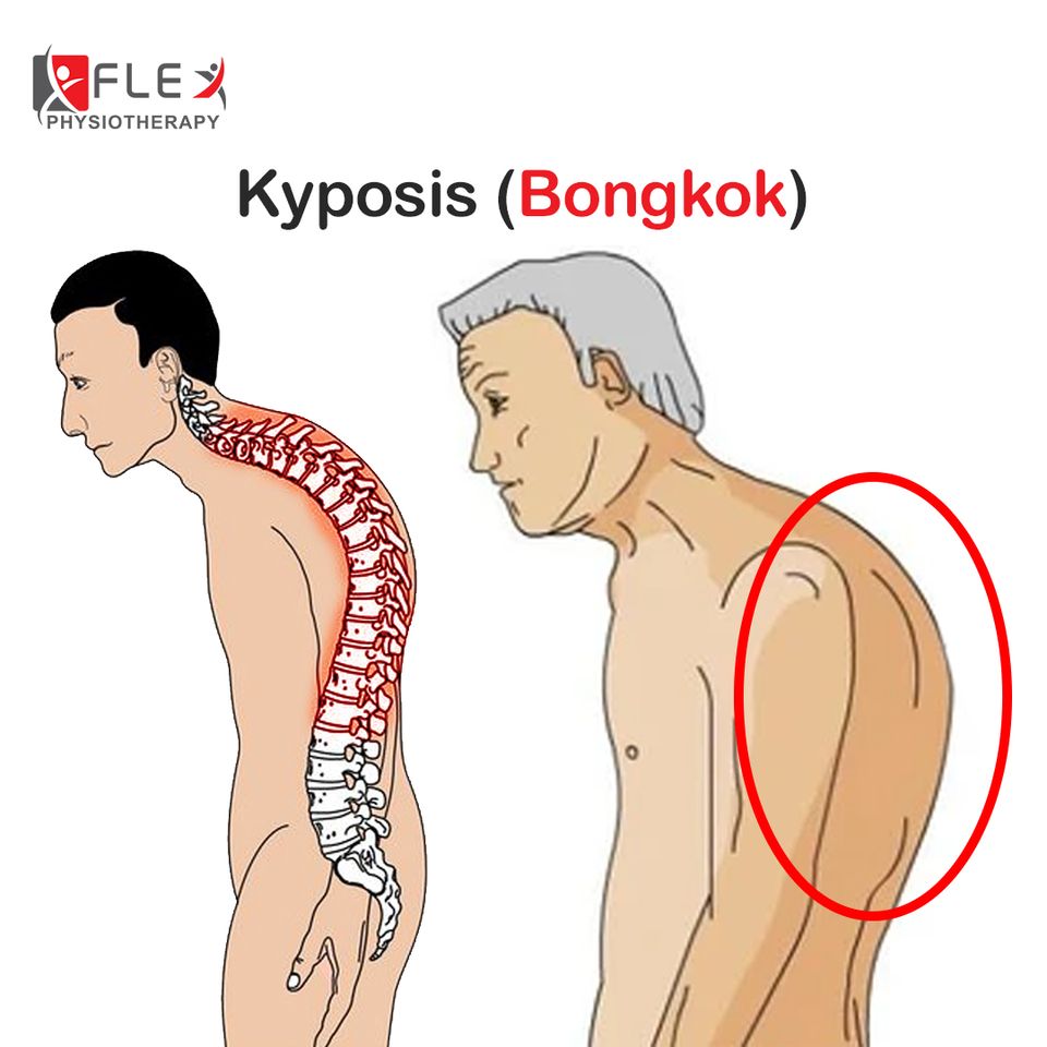 Bongkok nampak masalah biasa tapi…
