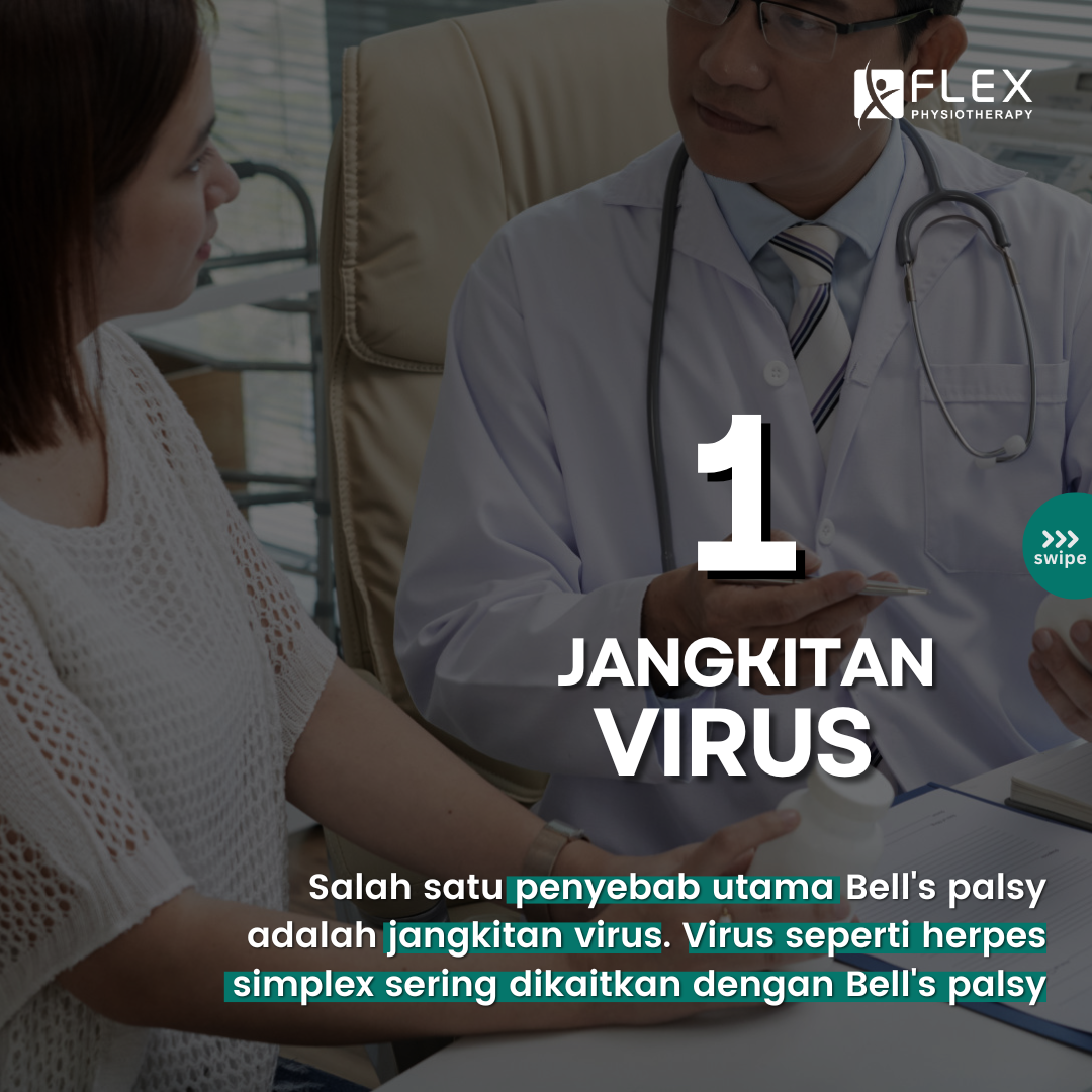 Bell's palsy disebabkan oleh jangkitan virus