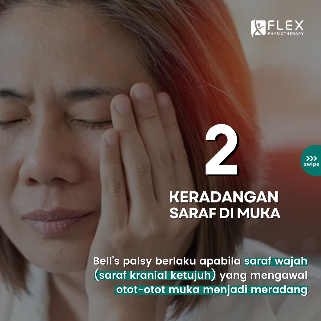 keradangan saraf di muka menyebabkan bell's palsy