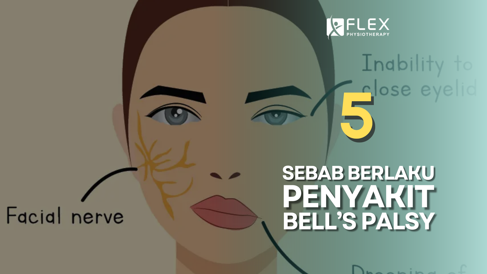 Bell’s Palsy: Apa Punca Sebenar?